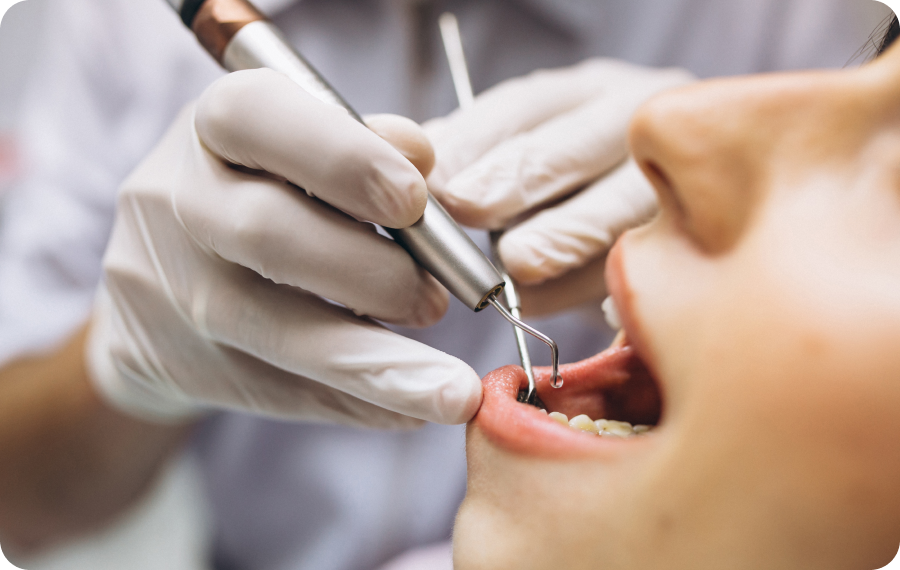 occlusion profonde orthosaive orthodontie occlusion profonde orthosaive orthodontie Inversé dentaire et déviation de la mâchoire inférieure Orthodontiste Altkirch | Dr Marie Saive & Dr Olivier Saive