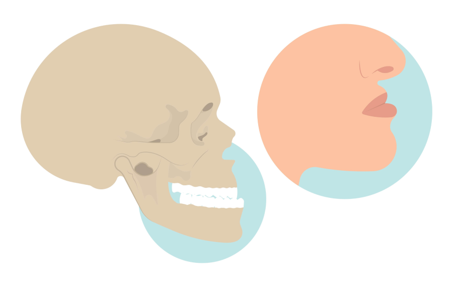orthodontie adulte orthosaive traitement orthodontie adulte orthosaive traitement Mâchoire inférieure trop en arrière ou trop en avant Orthodontiste Altkirch | Dr Marie Saive & Dr Olivier Saive