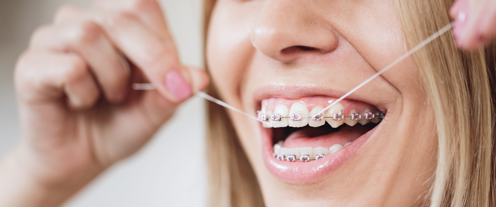 sourire esthetique orthosaive orthodontie Conseils Orthodontiste Altkirch | Dr Marie Saive & Dr Olivier Saive