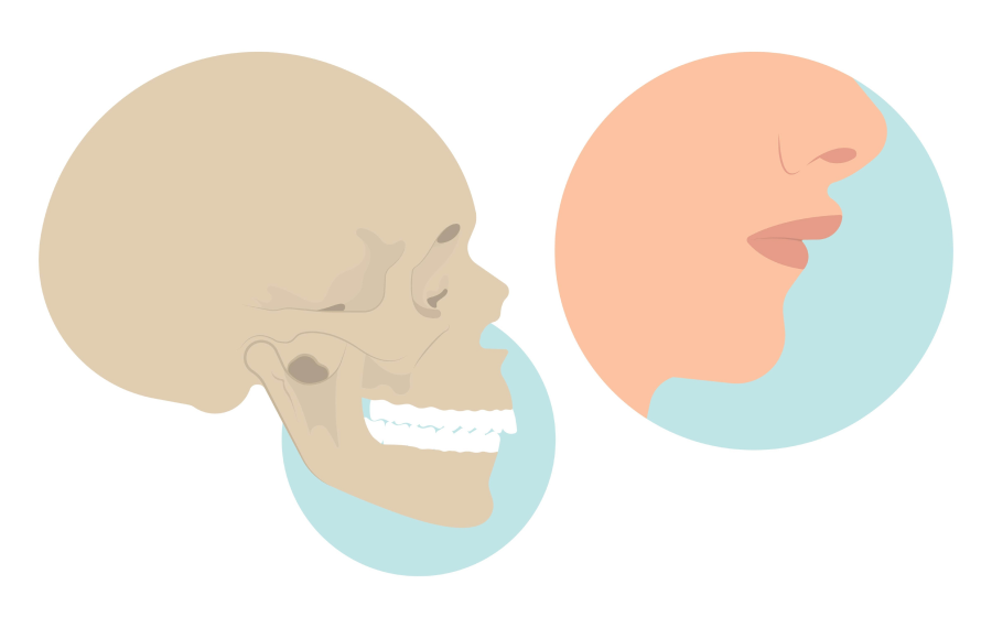 traitement fonctionnel orthosaive enfant traitement fonctionnel orthosaive enfant Mâchoire inférieure trop en arrière ou trop en avant Orthodontiste Altkirch | Dr Marie Saive & Dr Olivier Saive