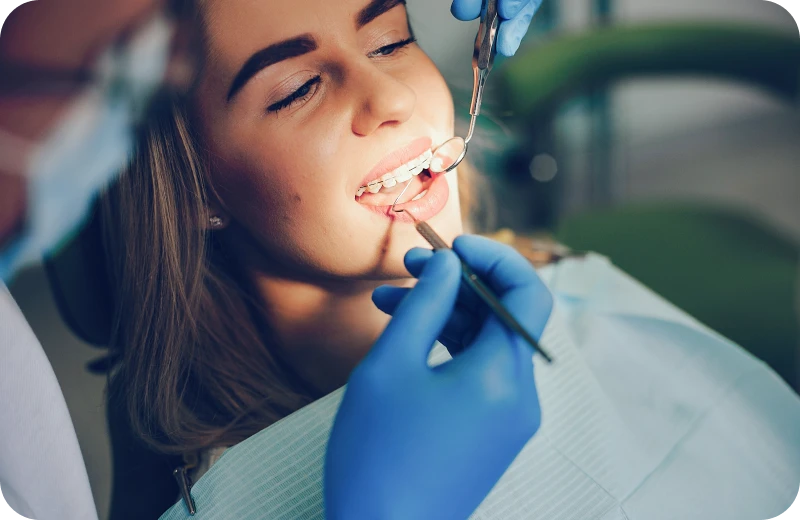 appareils fixes orthodontie altkirch appareils fixes orthodontie altkirch Appareil dentaire céramique Orthodontiste Altkirch | Dr Marie Saive & Dr Olivier Saive