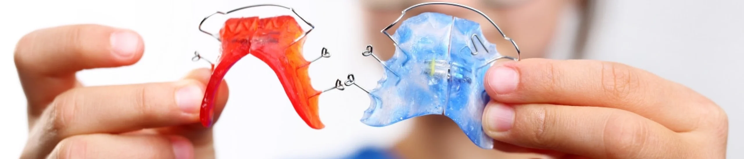suivi adulte orthodontie scaled Traitement d’interception Orthodontiste Altkirch | Dr Marie Saive & Dr Olivier Saive