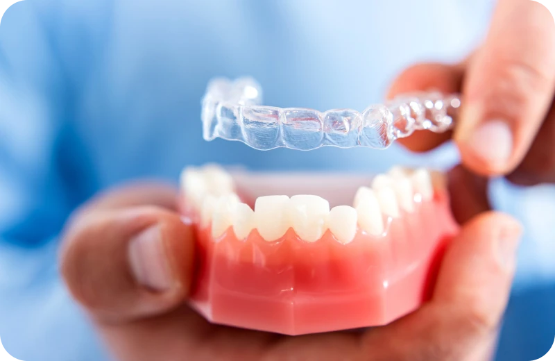traitement orthodontico chirurgical altkirch traitement orthodontico chirurgical altkirch Gouttières transparentes Orthodontiste Altkirch | Dr Marie Saive & Dr Olivier Saive