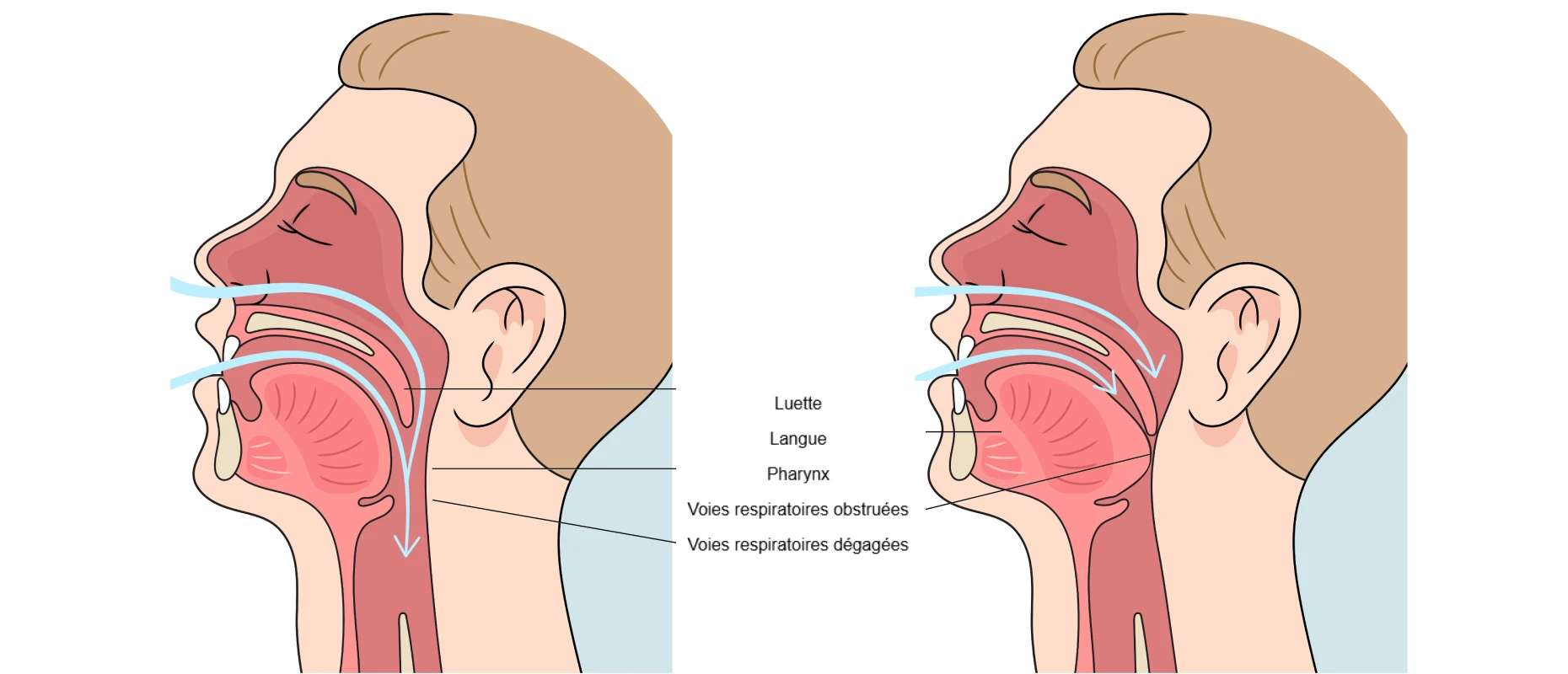 troubles articulaires orthodontie troubles articulaires orthodontie Orthèse anti-ronflement et anti-apnée Orthodontiste Altkirch | Dr Marie Saive & Dr Olivier Saive