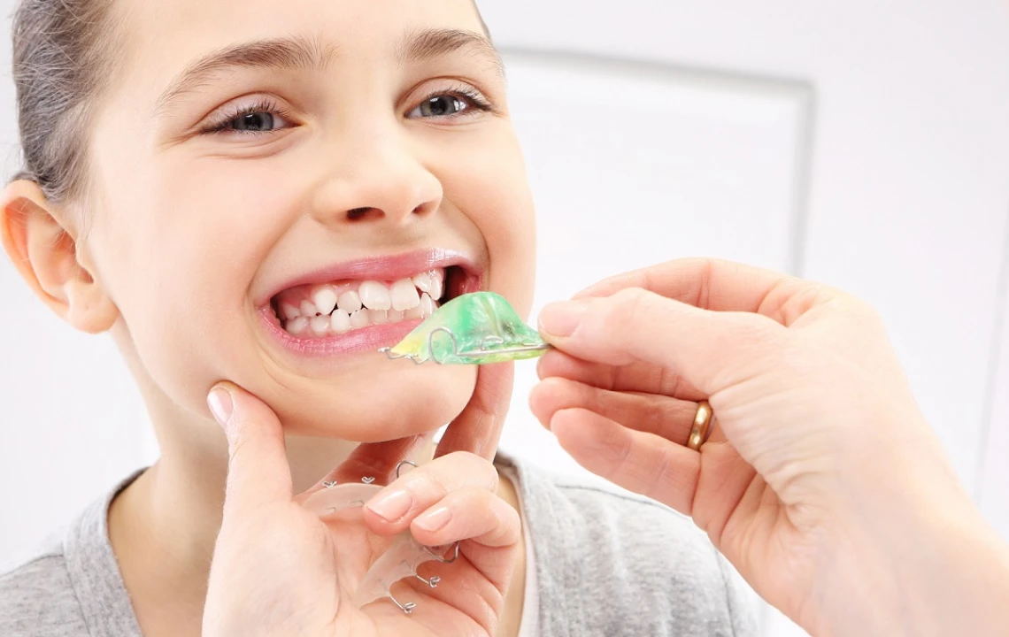 arcade dentaire etroite orthosaive Appareils amovibles : urgences Orthodontiste Altkirch | Dr Marie Saive & Dr Olivier Saive
