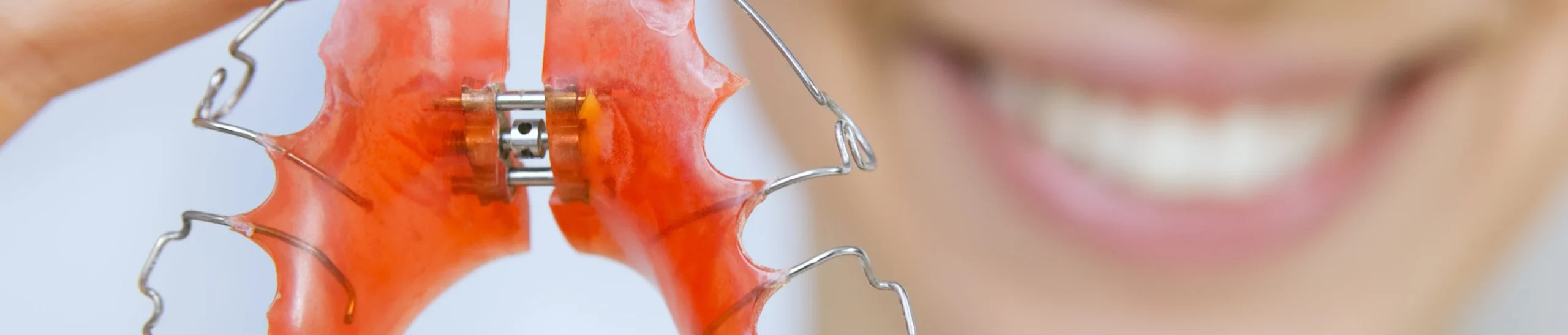 consultation enfant orthodontie scaled Appareils amovibles : urgences Orthodontiste Altkirch | Dr Marie Saive & Dr Olivier Saive