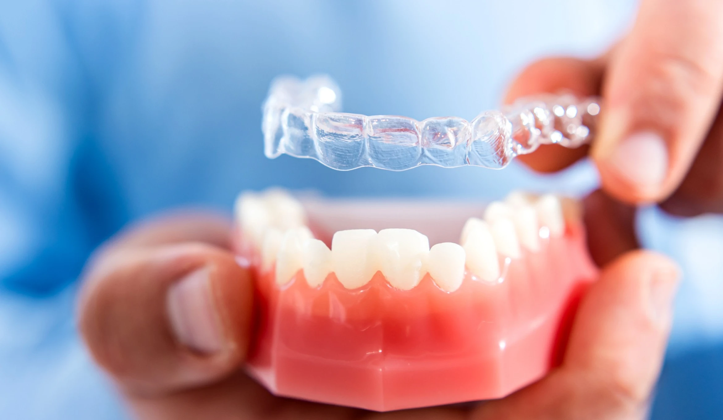 orthodontie gouttiere invisible altkirch Accueil Orthodontiste Altkirch | Dr Marie Saive & Dr Olivier Saive