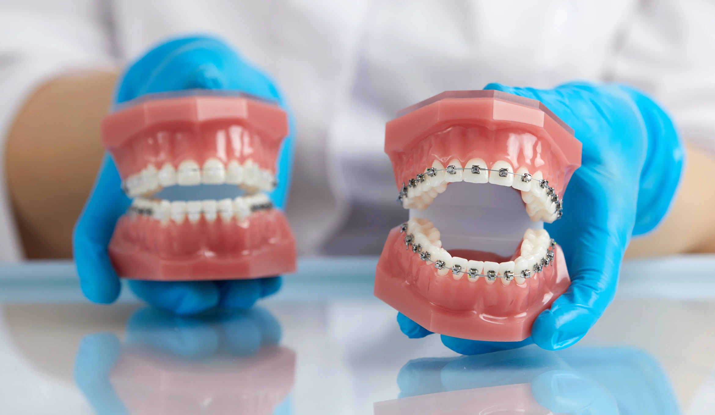 orthodontie metal altkirch cabinet Accueil Orthodontiste Altkirch | Dr Marie Saive & Dr Olivier Saive