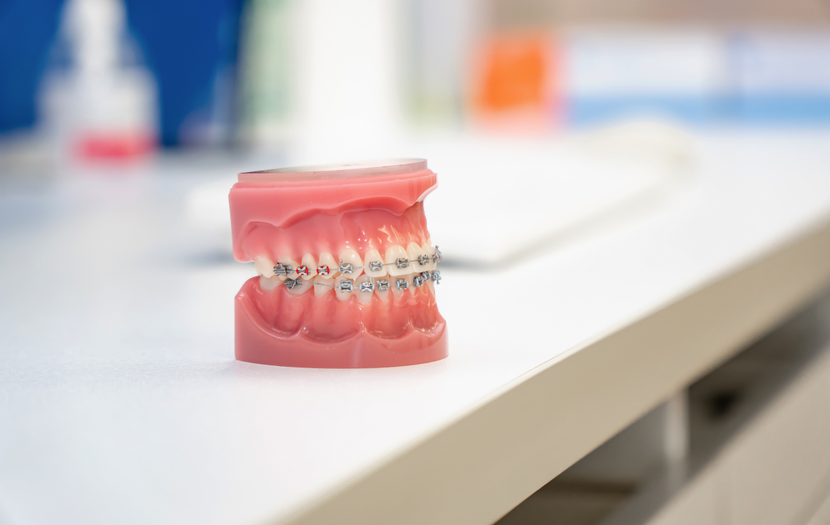 cabinet orthosaive educateur fonctionnel Accueil Orthodontiste Altkirch | Dr Marie Saive & Dr Olivier Saive